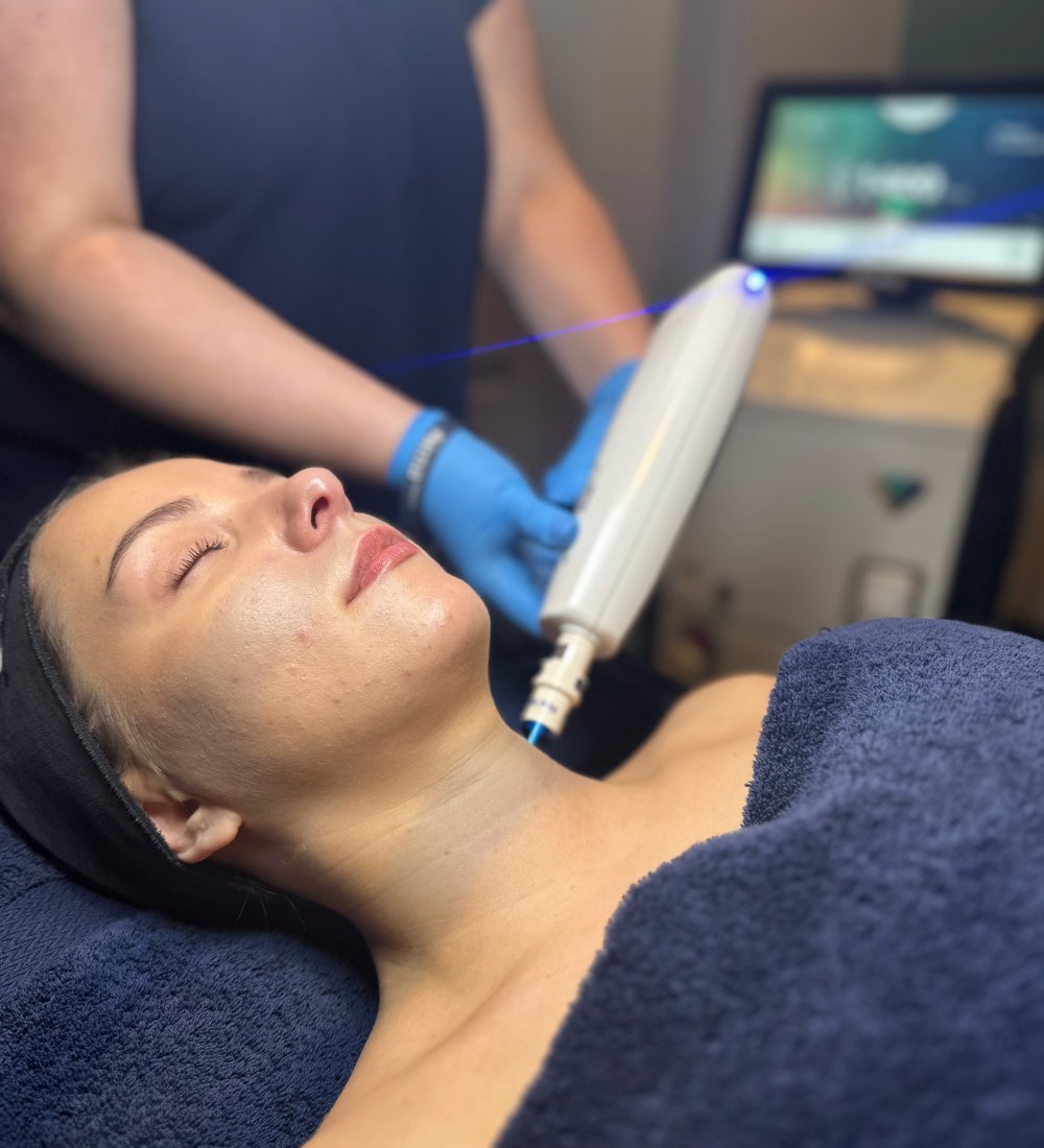 Client receiving Harmony XL PRO ClearLift treatment at SKIN lounge Aesthetics Richmond, using advanced fractional laser technology to lift, tone, and revitalise the skin without downtime.