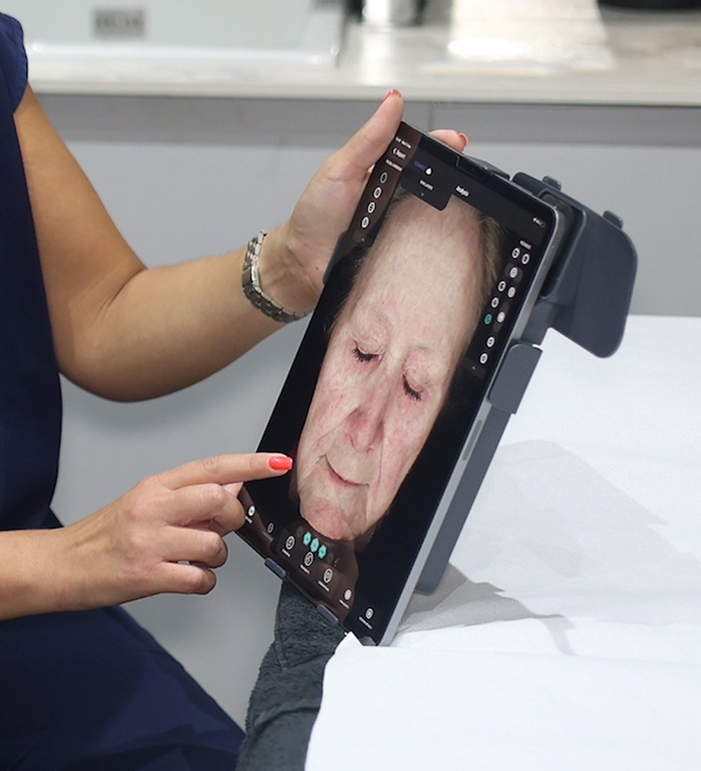 Client receiving a full skin consultation and OBSERV machine analysis at SKIN lounge Aesthetics Richmond Hill, using advanced imaging technology to assess skin condition, identify concerns, and create a tailored treatment and skincare plan.