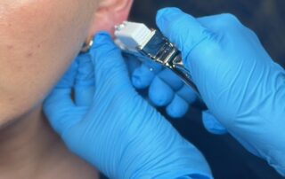 Sterex 9ct Gold Ear Piercing – SKIN lounge Aesthetics Richmond Client receiving a Sterex 9ct gold ear piercing at SKIN lounge Aesthetics Richmond, using a sterile, professional technique for safe results.