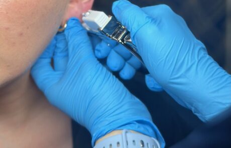 Sterex 9ct Gold Ear Piercing – SKIN lounge Aesthetics Richmond Client receiving a Sterex 9ct gold ear piercing at SKIN lounge Aesthetics Richmond, using a sterile, professional technique for safe results.