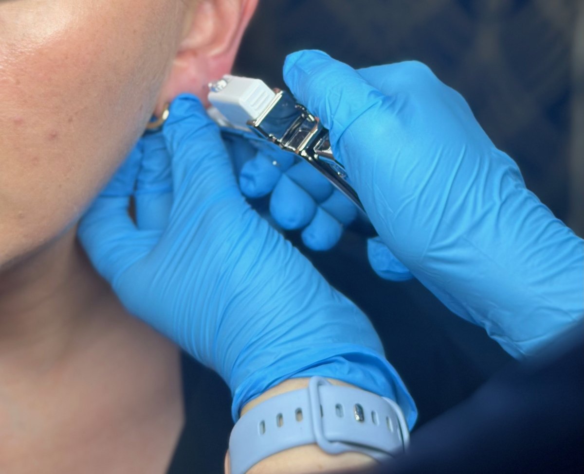 Sterex 9ct Gold Ear Piercing – SKIN lounge Aesthetics Richmond Client receiving a Sterex 9ct gold ear piercing at SKIN lounge Aesthetics Richmond, using a sterile, professional technique for safe results.