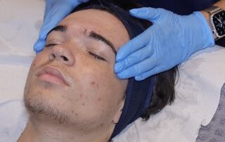 HydraClean Deep-Cleansing Facial – SKIN lounge Aesthetics Richmond Client enjoying a HydraClean deep-cleansing facial at SKIN lounge Aesthetics Richmond Hill, an expert treatment combining professional techniques and targeted skincare to deeply cleanse, purify, and reduce acne, congestion, and scarring.