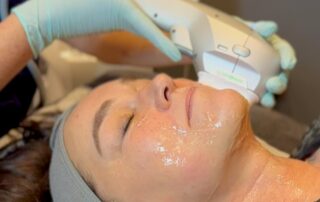HydraLift Facial with HIFU Ultraformer III – SKIN lounge Aesthetics Richmond Hill Client enjoying a HydraLift facial at SKIN lounge Aesthetics Richmond Hill, combining advanced Hydra technology with HIFU Ultraformer III to deeply cleanse, hydrate, lift, and firm the skin for remarkable anti-ageing and rejuvenating results. Lifting and firming in real time