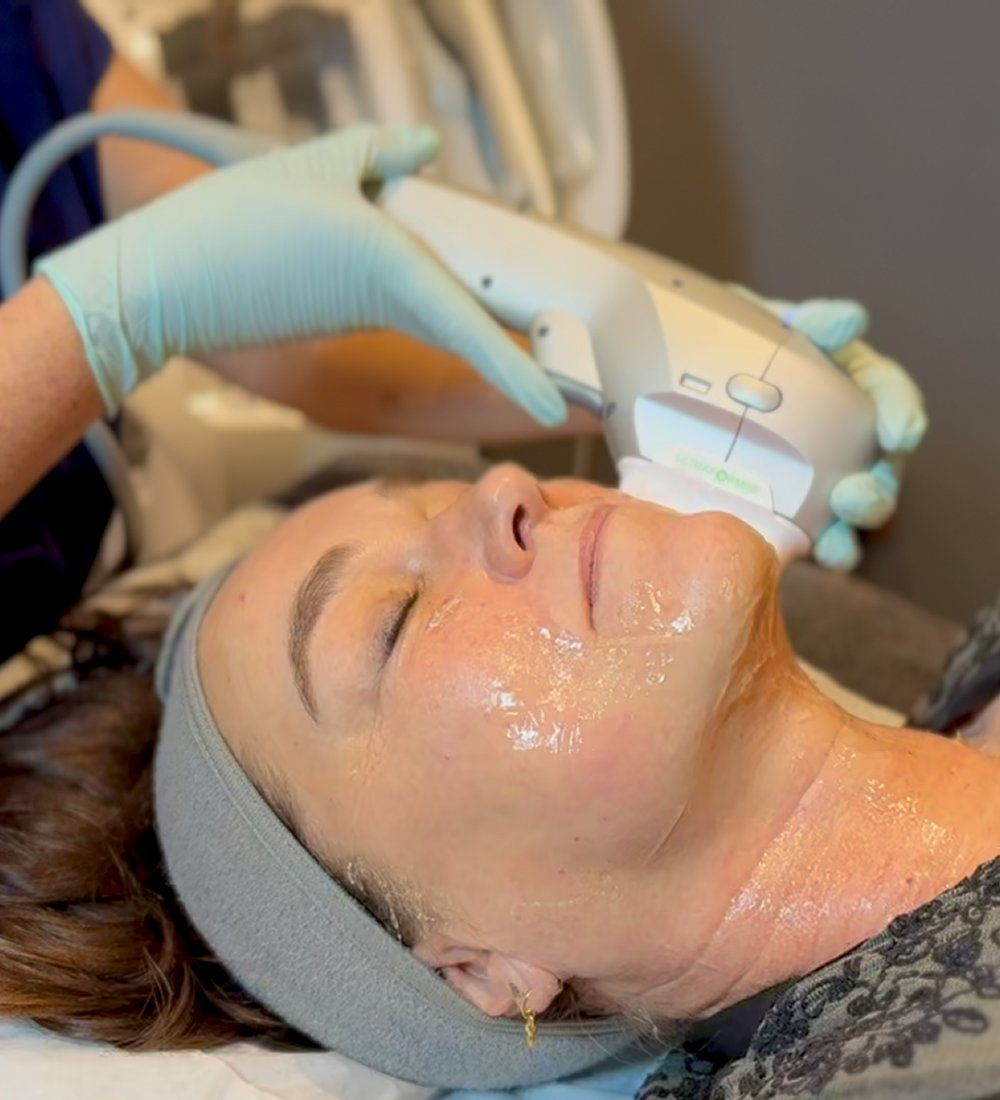 Client enjoying a HydraLift facial at SKIN lounge Aesthetics Richmond Hill, combining advanced Hydra technology with HIFU Ultraformer III to deeply cleanse, hydrate, lift, and firm the skin for remarkable anti-ageing and rejuvenating results. Lifting and firming in real time