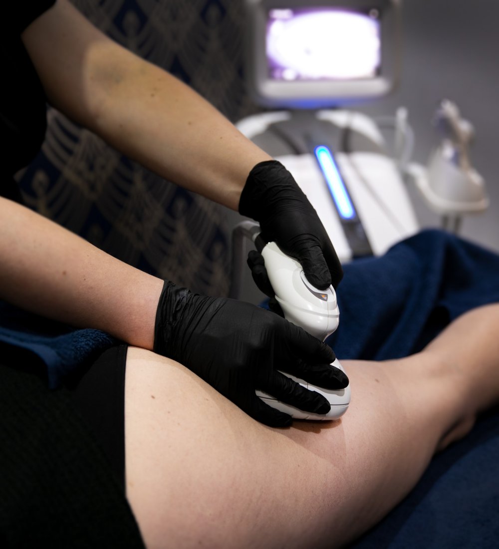 Client receiving T-Shape body sculpting and cellulite reduction treatment at SKIN lounge Aesthetics Richmond, using advanced multi-technology to firm, smooth, and contour the body. and encourages lymphatic drainage